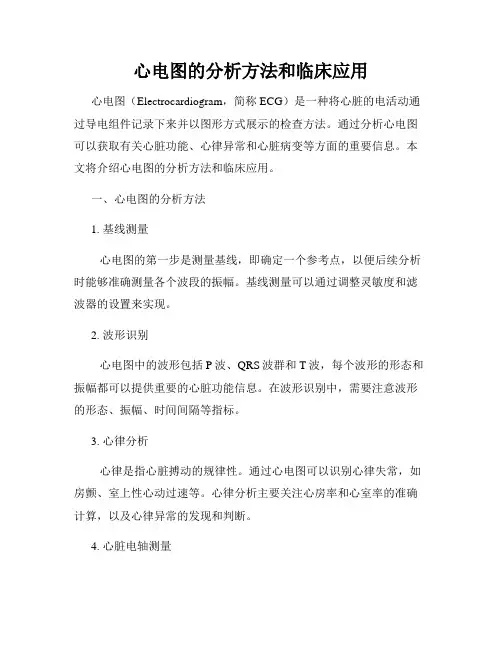 心电图的分析方法和临床应用