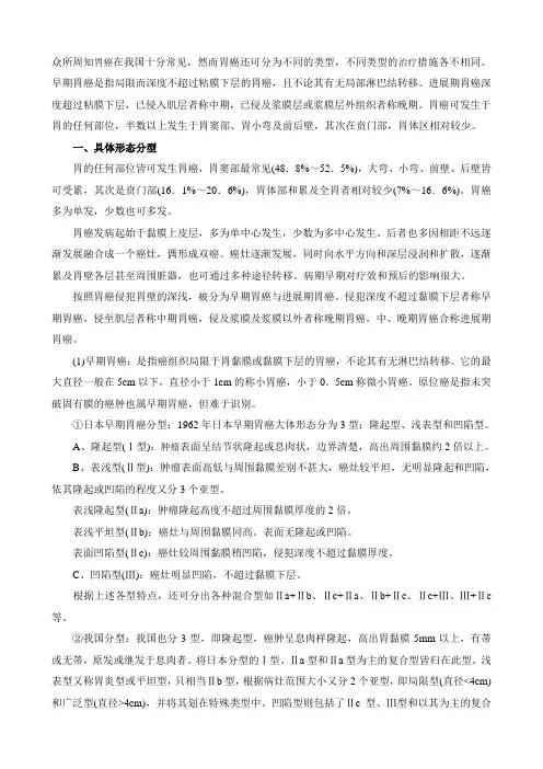 胃癌分型