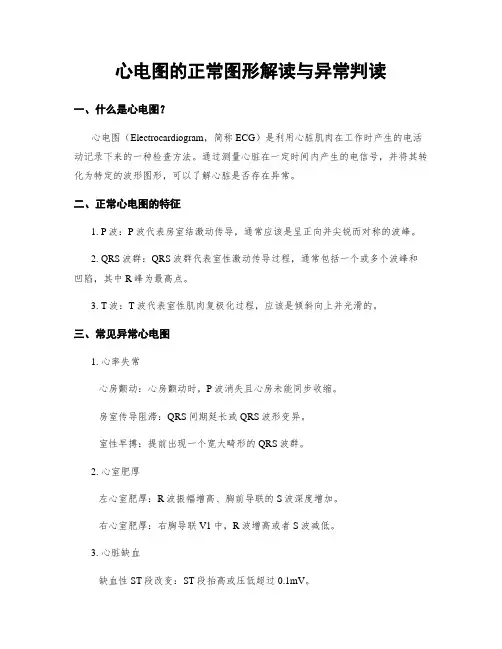 心电图的正常图形解读与异常判读