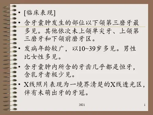 颌骨囊肿——牙源性囊肿PPT课件