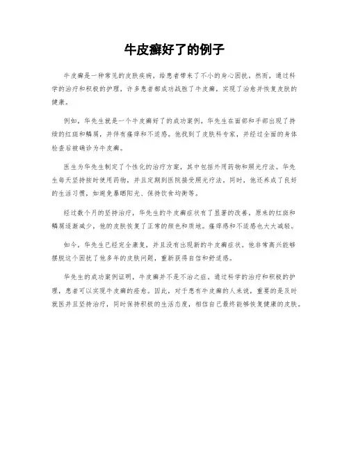 牛皮癣好了的例子