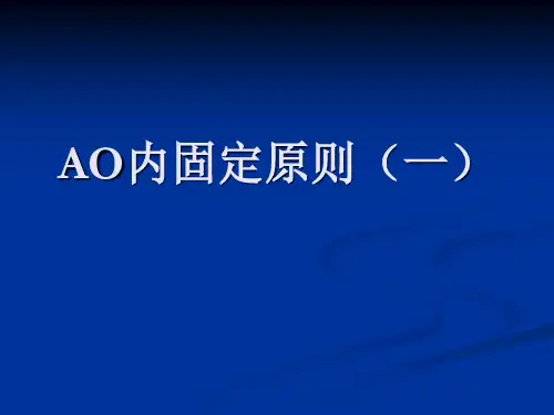 AO内固定原则