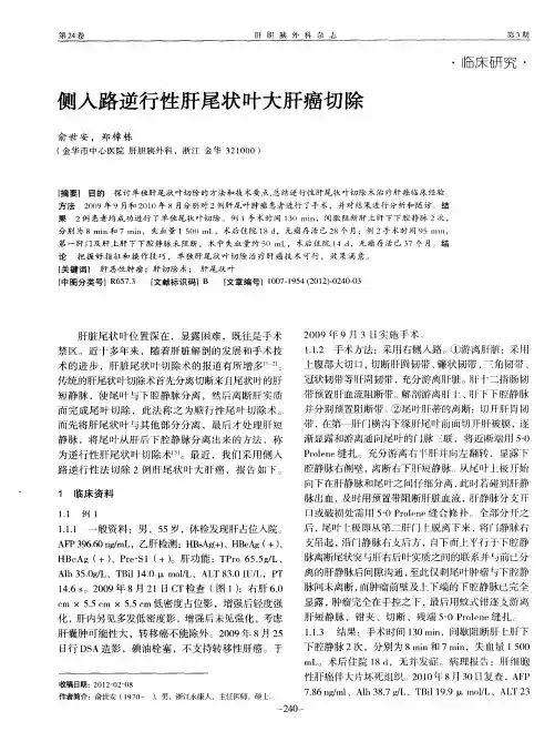侧入路逆行性肝尾状叶大肝癌切除