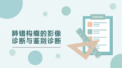 肺错构瘤的影像诊断与鉴别诊断