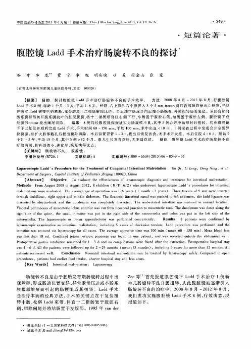 腹腔镜Ladd手术治疗肠旋转不良的探讨