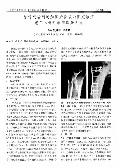 肱骨近端锁定加压接骨板内固定治疗老年肱骨近端四部分骨折