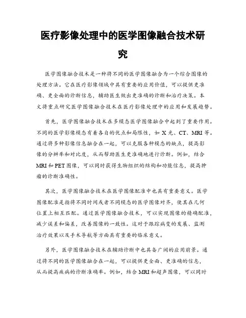 医疗影像处理中的医学图像融合技术研究