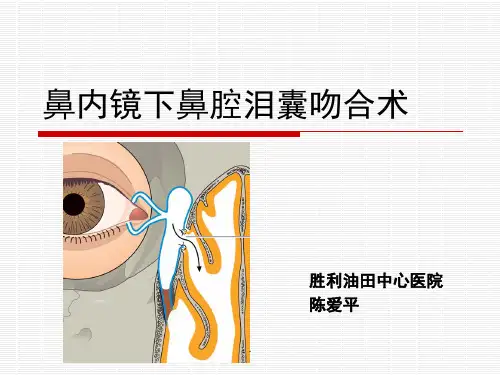 鼻内镜鼻腔泪囊吻合术PPT课件