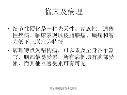 结节性硬化影像表现课件