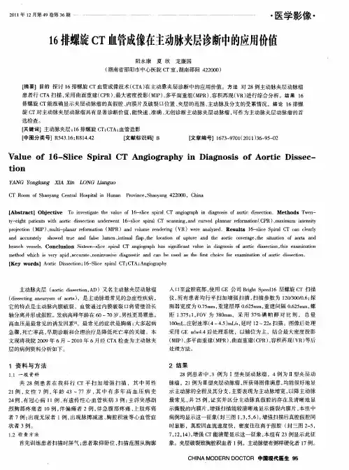 16排螺旋CT血管成像在主动脉夹层诊断中的应用价值