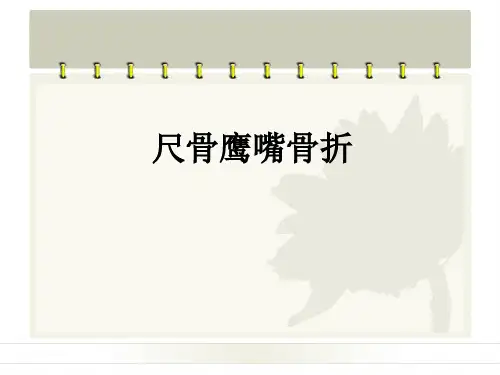 (推荐课件)尺骨鹰嘴骨折PPT幻灯片