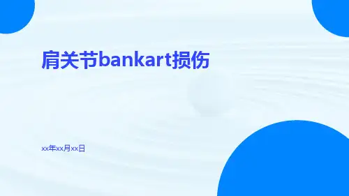 (医学课件)肩关节bankart损伤