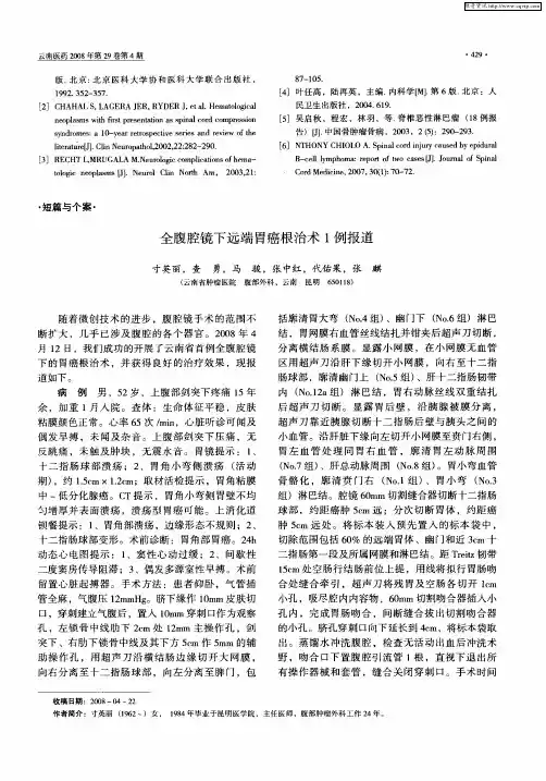 全腹腔镜下远端胃癌根治术1例报道