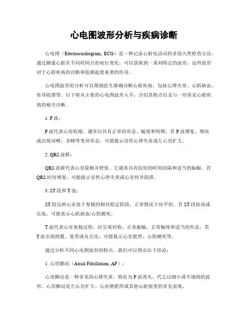 心电图波形分析与疾病诊断