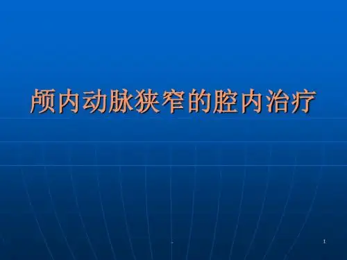 颅内动脉狭窄PPT课件
