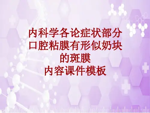 内科学_各论_症状：口腔粘膜有形似奶块的斑膜_课件模板