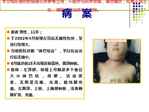 淋巴瘤教学专业知识讲座培训课件