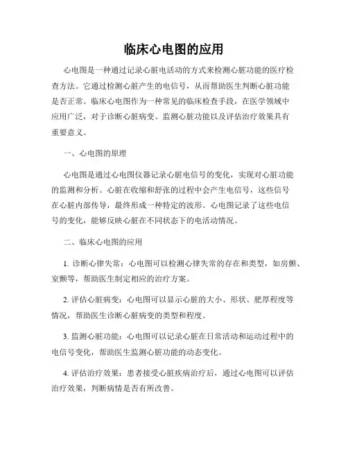 临床心电图的应用