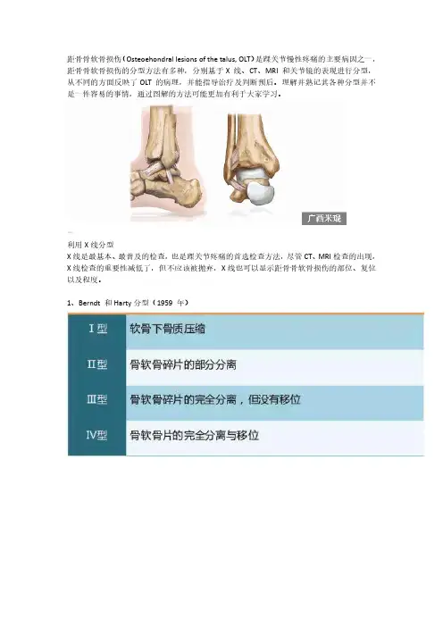 距骨骨软骨损伤的分型图解