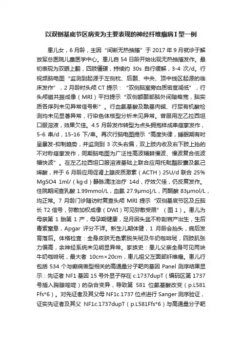 以双侧基底节区病变为主要表现的神经纤维瘤病I型一例