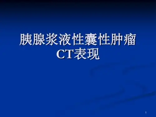胰腺浆液性囊腺瘤CT表现PPT课件