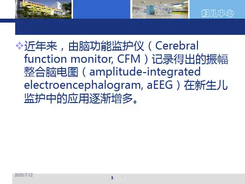 振幅整合脑电图在临床的应用ppt课件