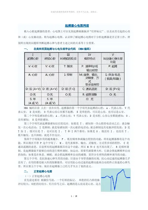 起搏器心电图判读