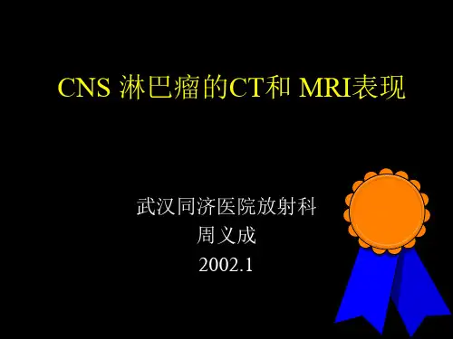 CNS淋巴瘤的CT和MRI表现PPT课件