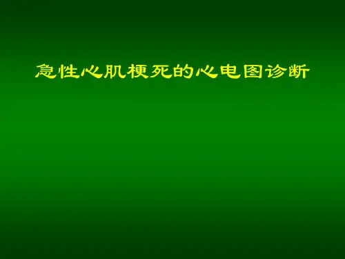 急性心肌梗死心电图