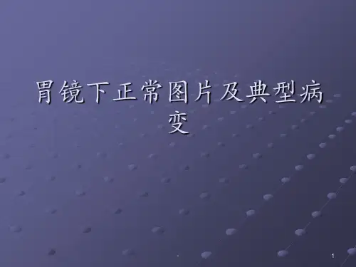 正常胃镜图片及常见病变ppt课件