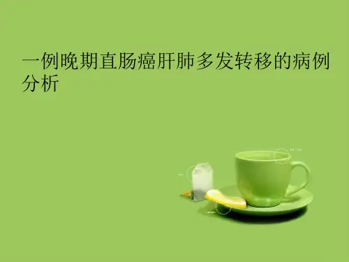 一例晚期直肠癌肝肺多发转移的病例分析