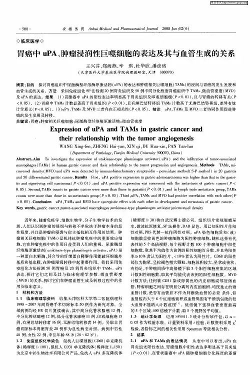 胃癌中uPA、肿瘤浸润性巨噬细胞的表达及其与血管生成的关系