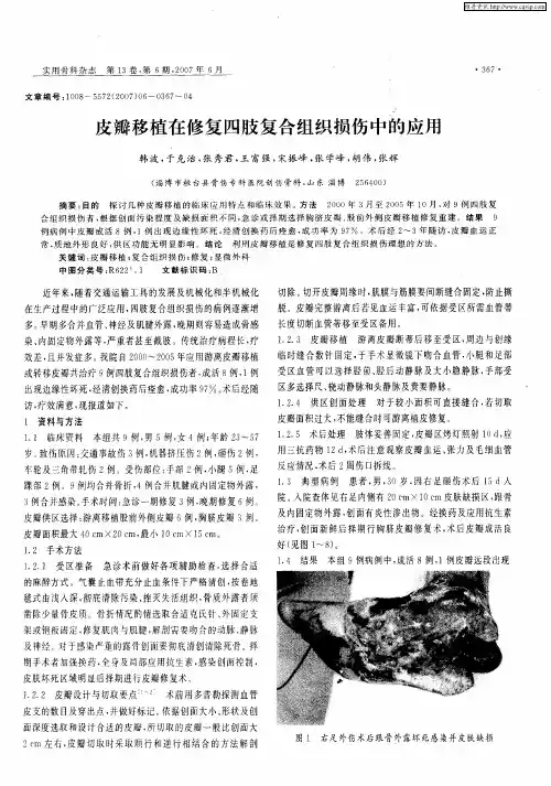 皮瓣移植在修复四肢复合组织损伤中的应用