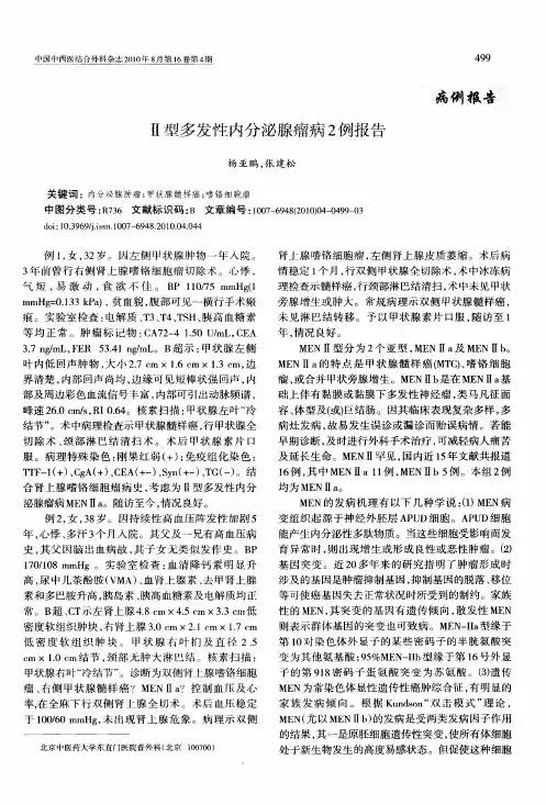 Ⅱ型多发性内分泌腺瘤病2例报告