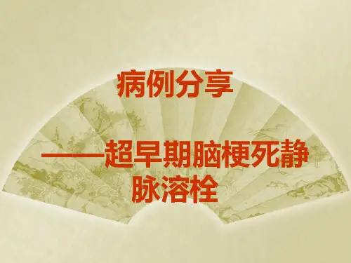 脑卒中静脉溶栓经验及病例分享[优质PPT]