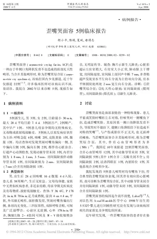 歪嘴哭面容5例临床报告