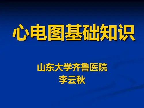 心电图
