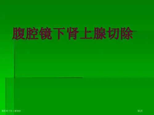 腹腔镜下肾上腺切除