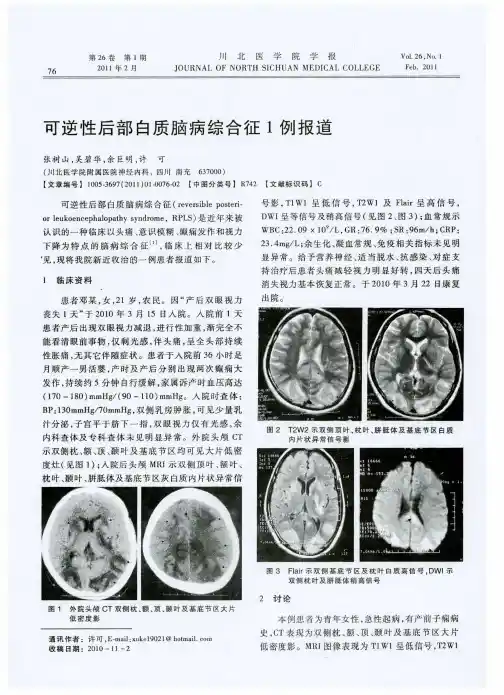 可逆性后部白质脑病综合征1例报道