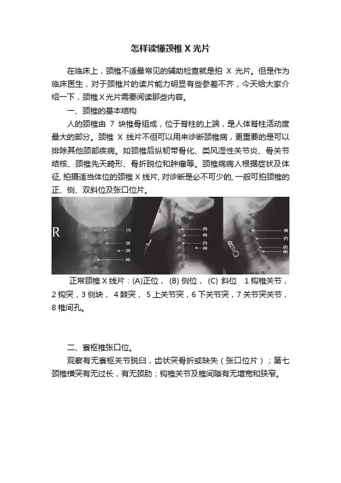 怎样读懂颈椎X光片