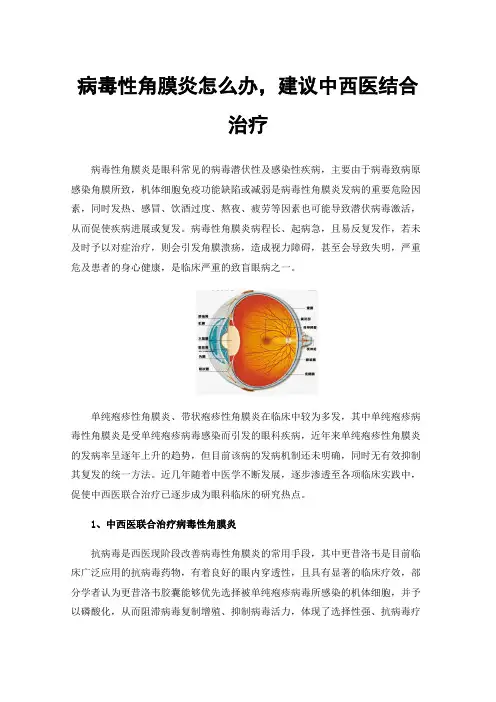 病毒性角膜炎怎么办，建议中西医结合治疗