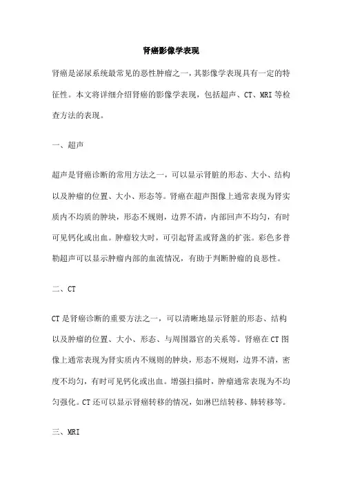 肾癌影像学表现