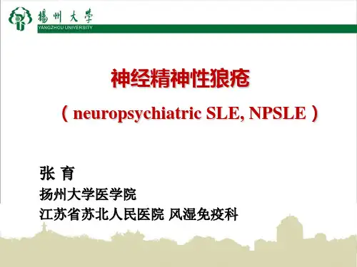 神经精神性狼疮