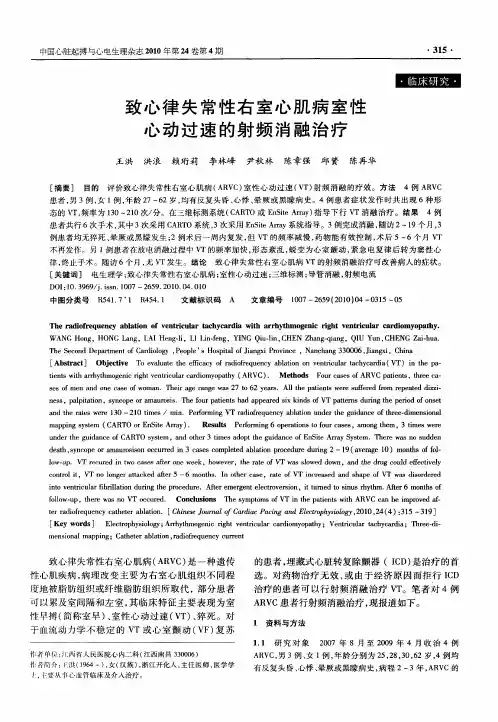 致心律失常性右室心肌病室性心动过速的射频消融治疗