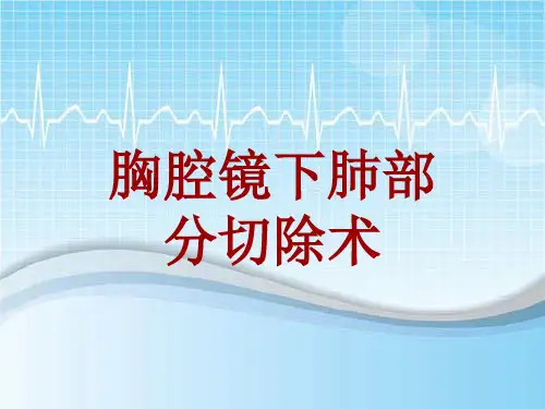 手术讲解模板：胸腔镜下肺部分切除术