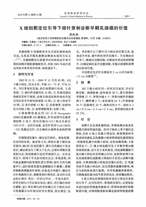 X线钼靶定位引导下细针穿刺诊断早期乳腺癌的价值