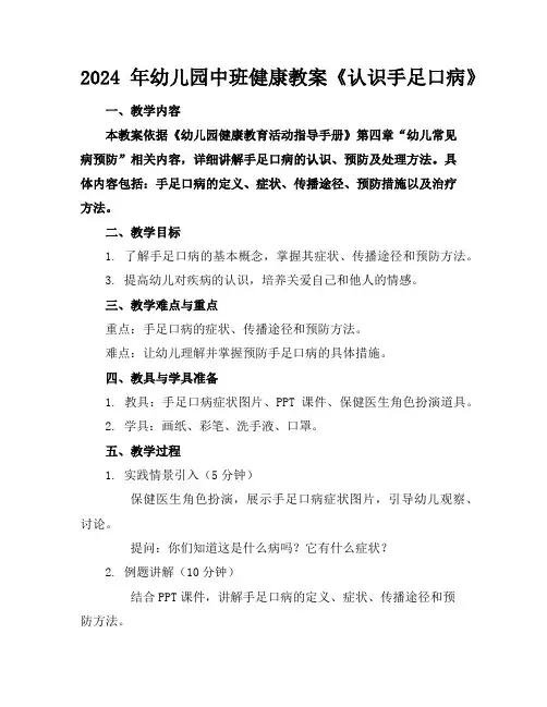 2024年幼儿园中班健康教案《认识手足口病》