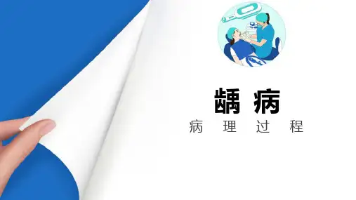 龋病临床表现与诊断(口腔内科学课件)