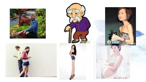 上交叉与下交叉综合征(1)