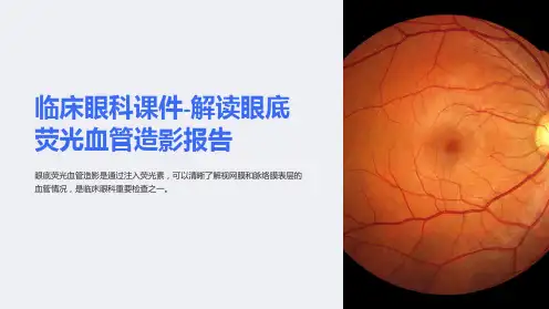 临床眼科课件-解读眼底荧光血管造影报告